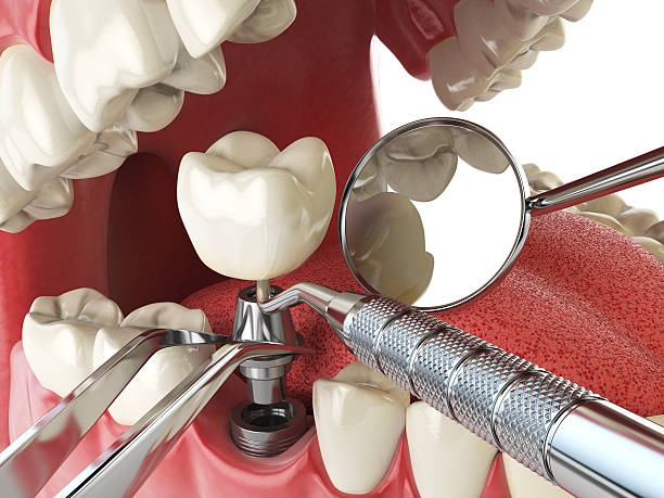 Best Emergency Root Canal Therapy in Gardiner, ME